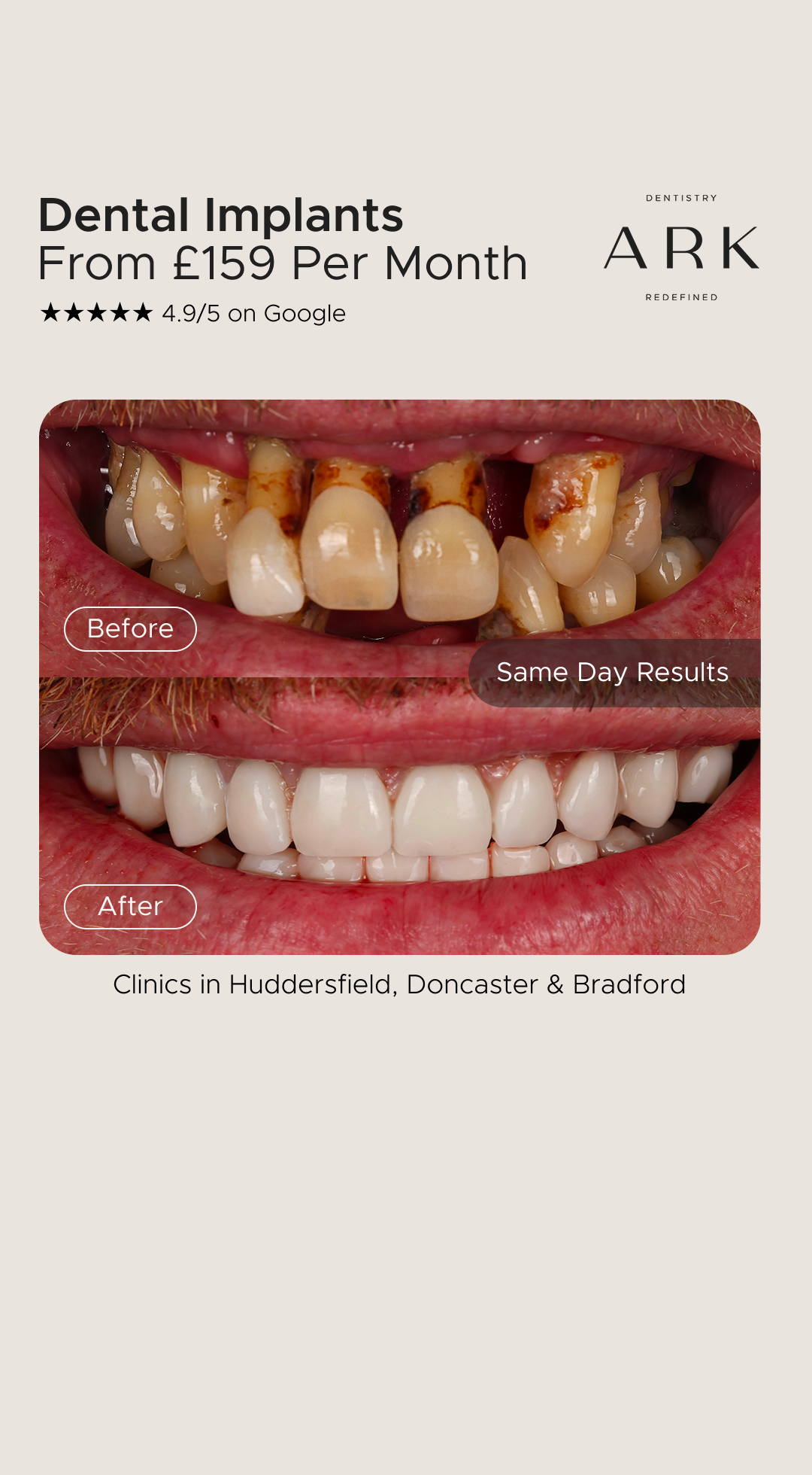 Ark Dentistry  Facebook ad