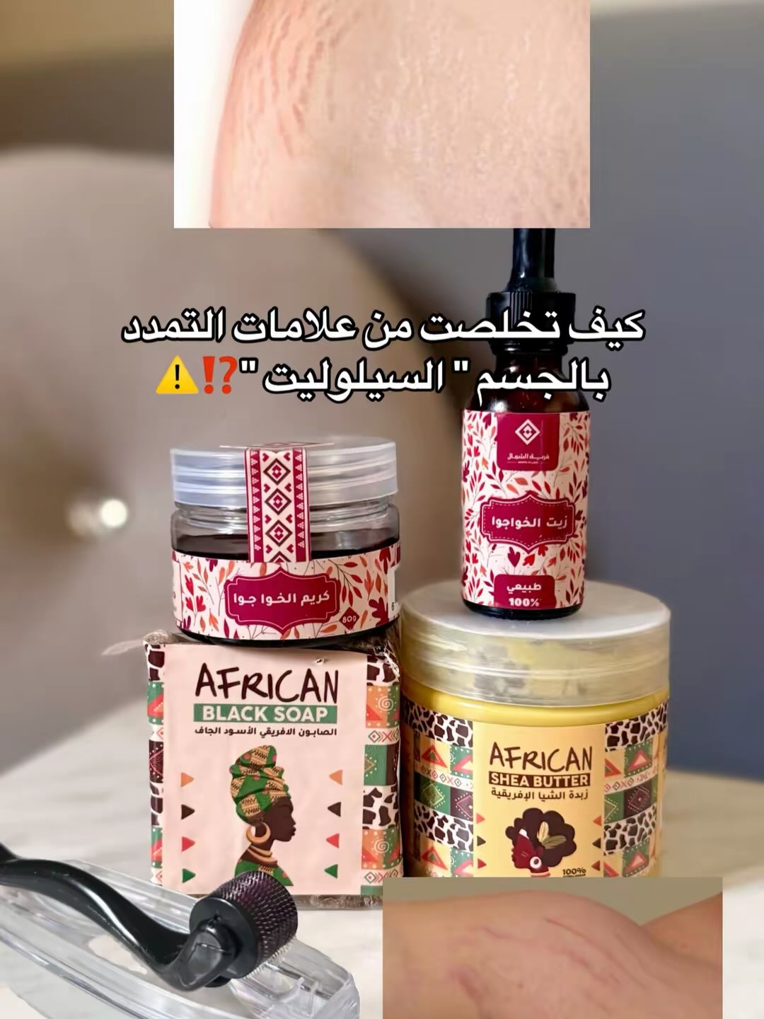 متجر قرية الشمال Facebook ad: ودعي خطوط التمدد والتشققات
