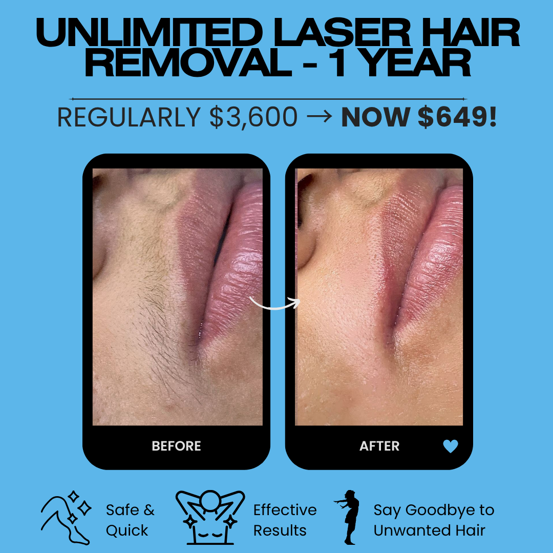 Sculpt PA Facebook ad: Unlimited Laser Hair Removal for 1 Year NOW $649!