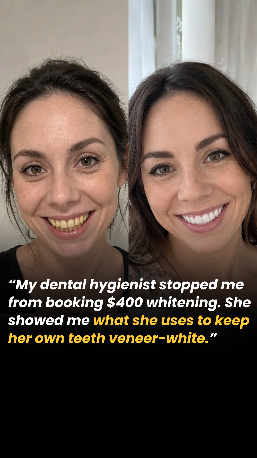 Healthy Living Daily Facebook ad: The $30 Dental Hygienist Secret