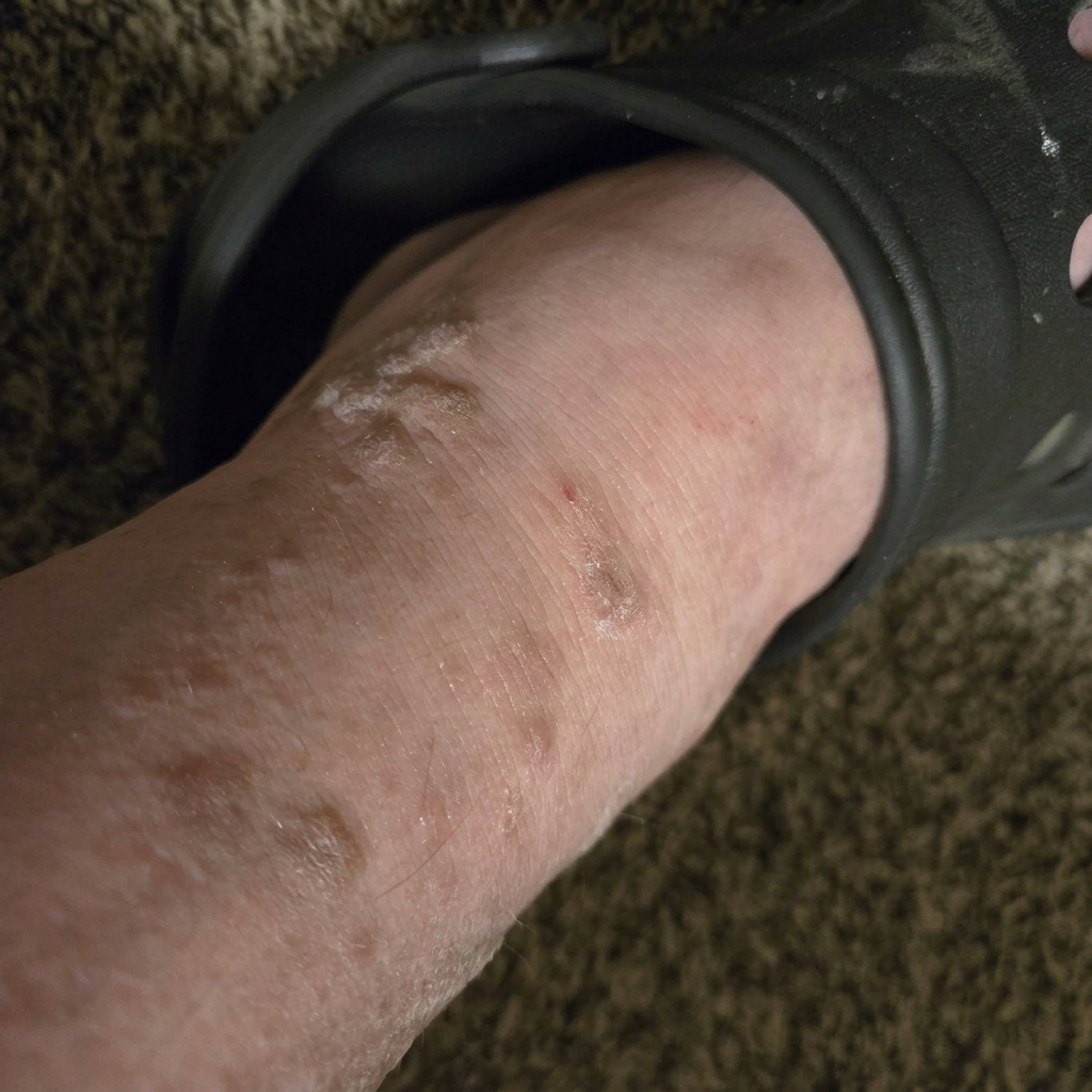 Wellness Journal UK Facebook ad: The 3 Stages of Neuropathy