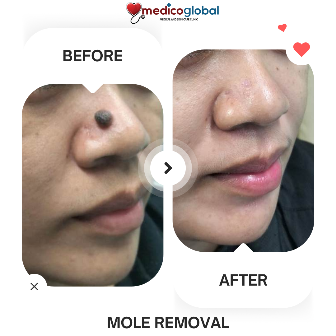 Medico Global Clinic - GH Mall Greenhills San Juan Facebook ad: Chat on Messenger