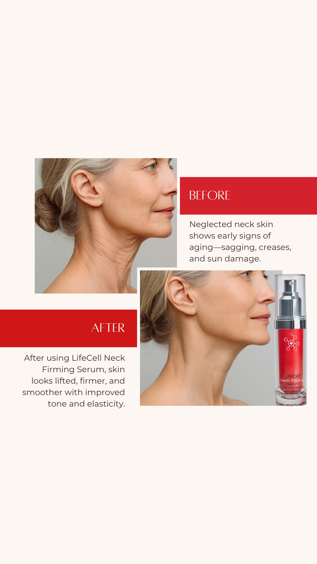 LifeCell Neck Serum Facebook ad