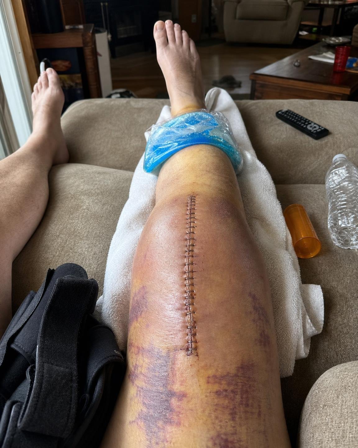 Linda Baker Facebook ad: 12 years of bone-on-bone knee pain gone in 2 days?