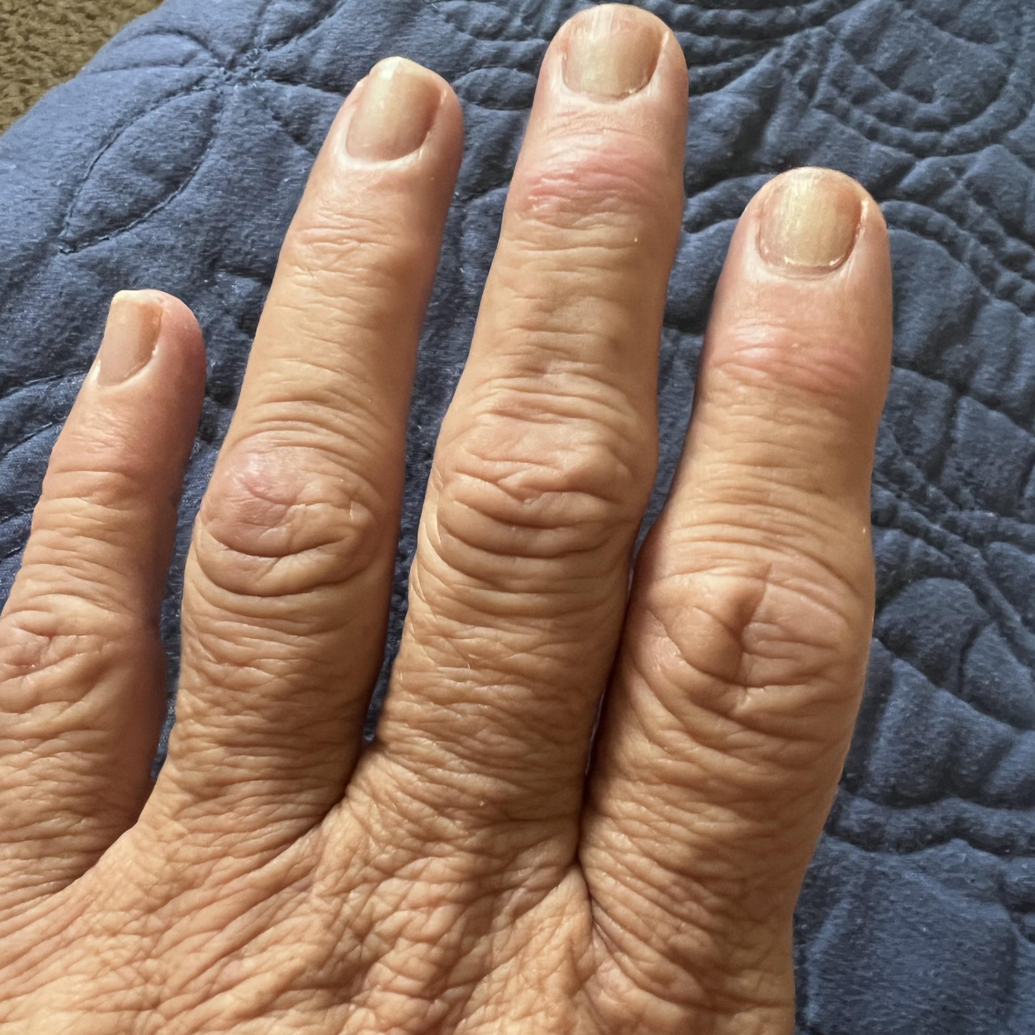 Deborah Rustad Facebook ad: Best mineral for rheumatoid arthritis pain?
