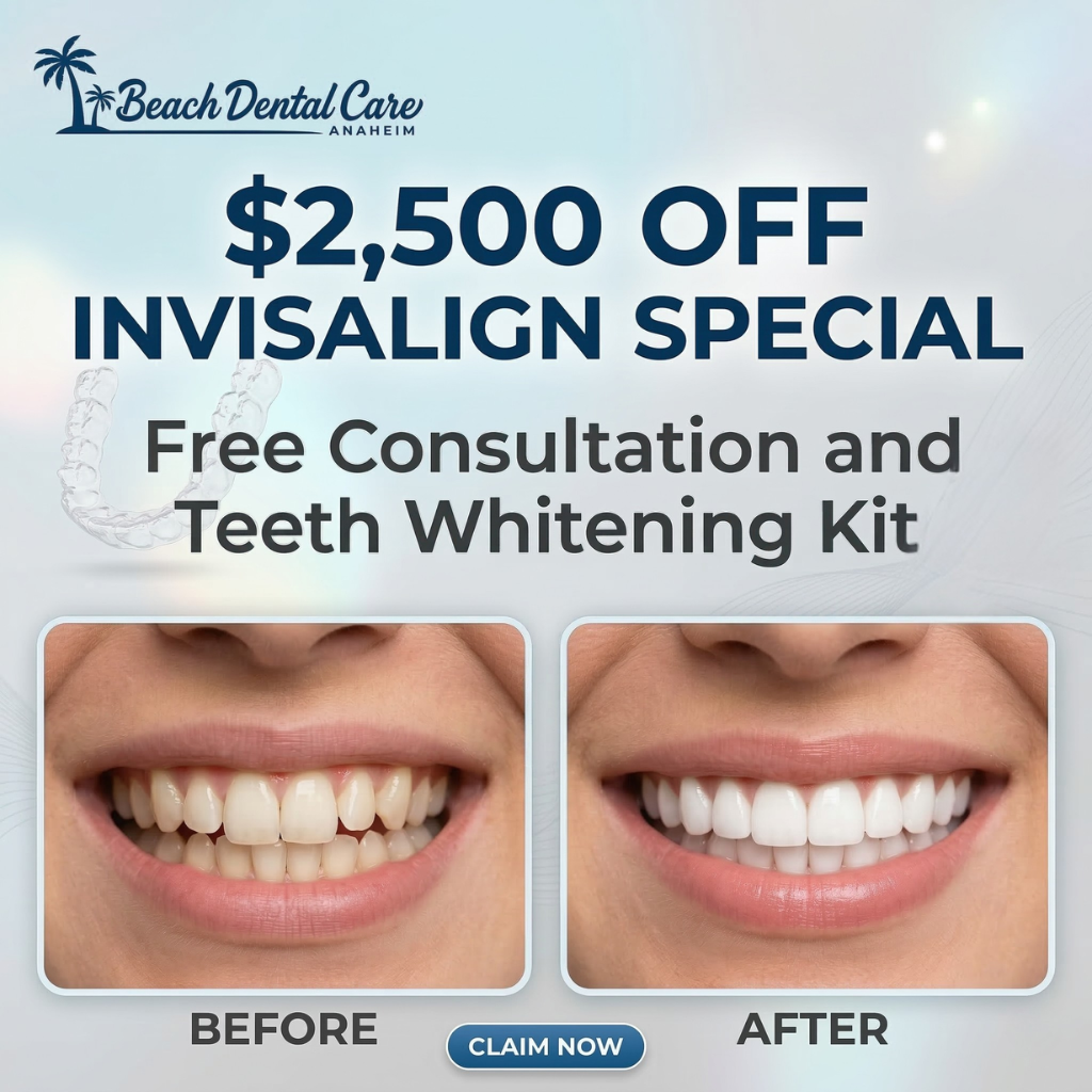 Beach Dental Care Anaheim Facebook ad: Get $2,500 OFF Invisalign + Payment Plans as Low as…