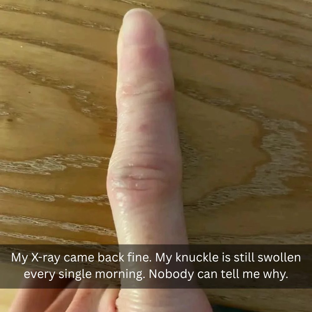 The Menopause Journal Facebook ad: Menopause did this to her hands