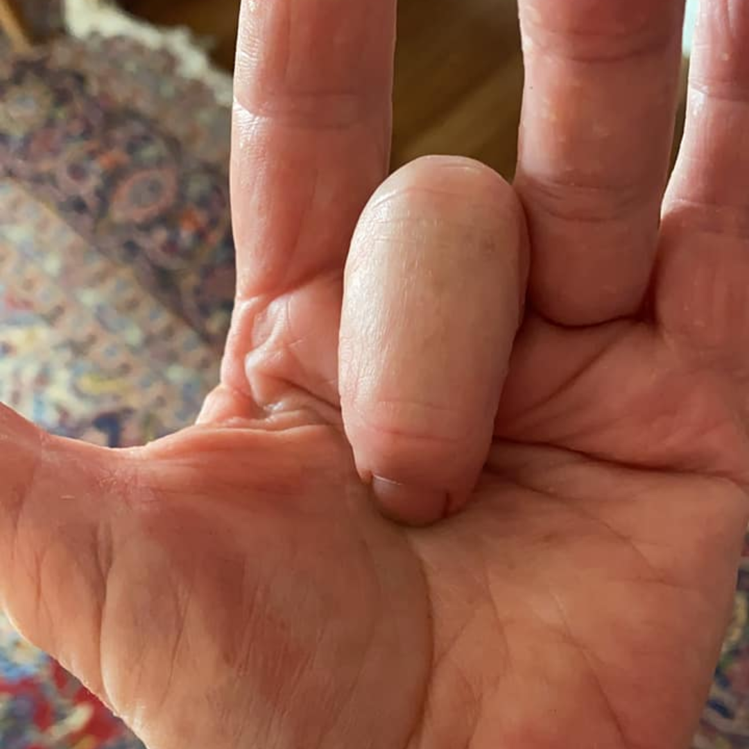 The Daily Wellness Journal Facebook ad: Read This If Your Finger Catches, Locks, and Snaps