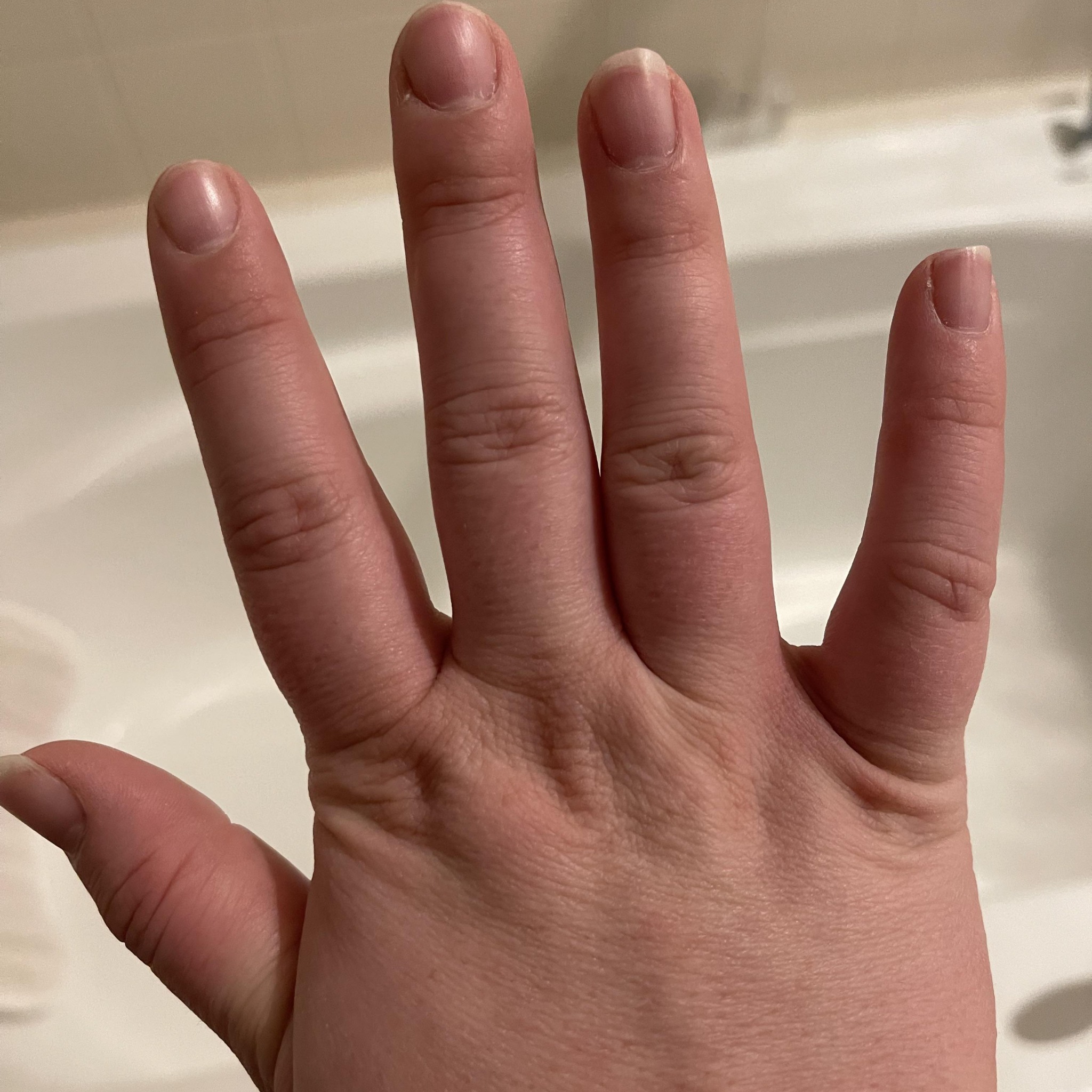 Deborah Rustad Facebook ad: Best mineral for rheumatoid arthritis pain?