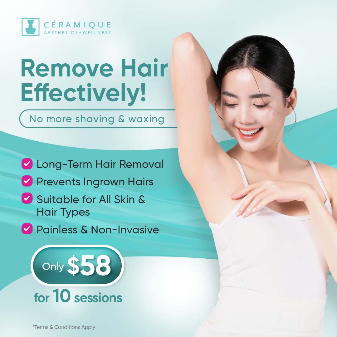 Ceramique Aesthetics Facebook ad