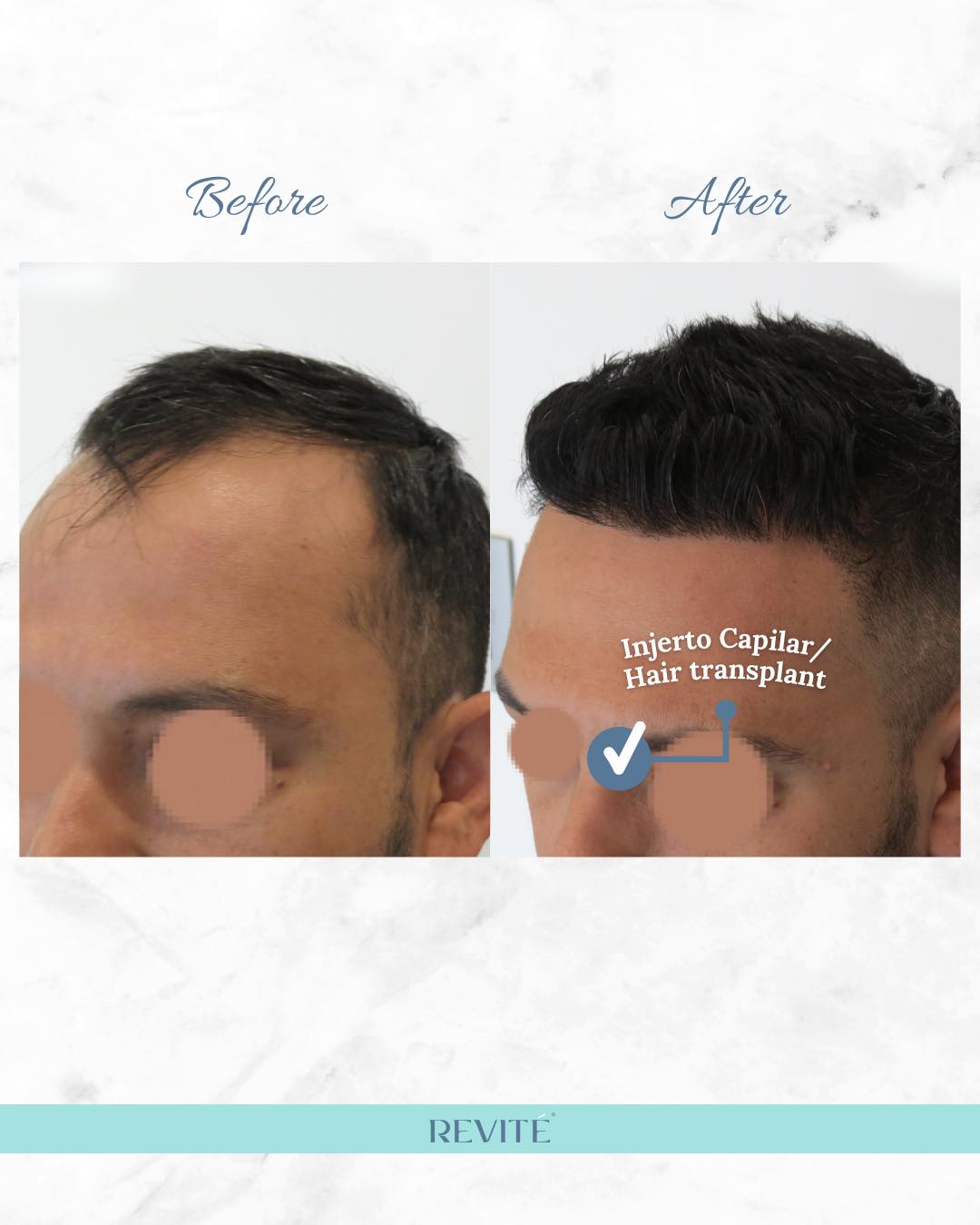 Revité Facebook ad