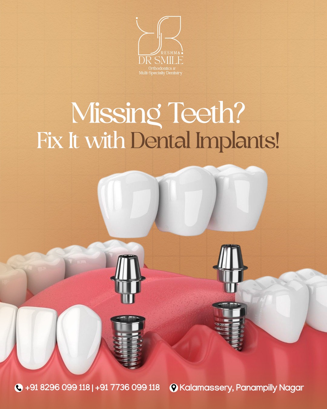 Dr Smile Orthodontics and Multispeciality Dentistry Facebook ad: Missing a Tooth?