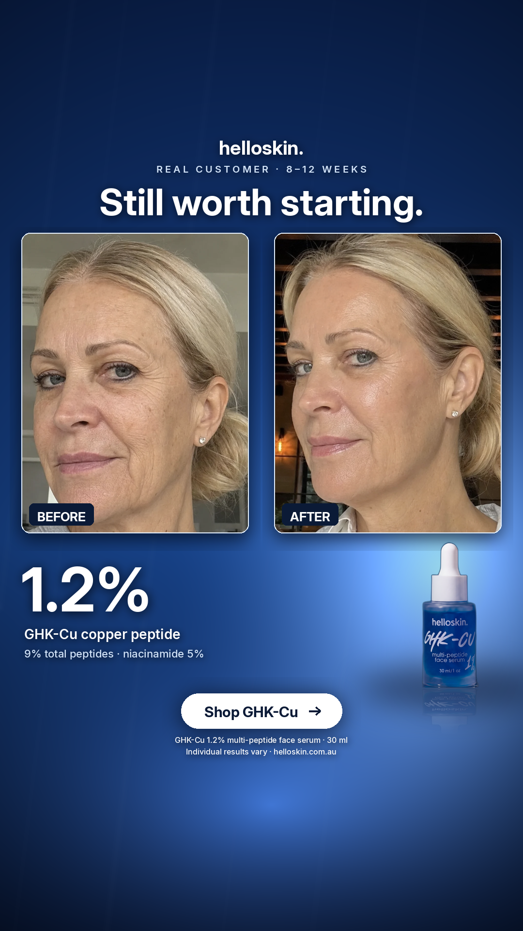 Helloskin Facebook ad: Still worth starting.