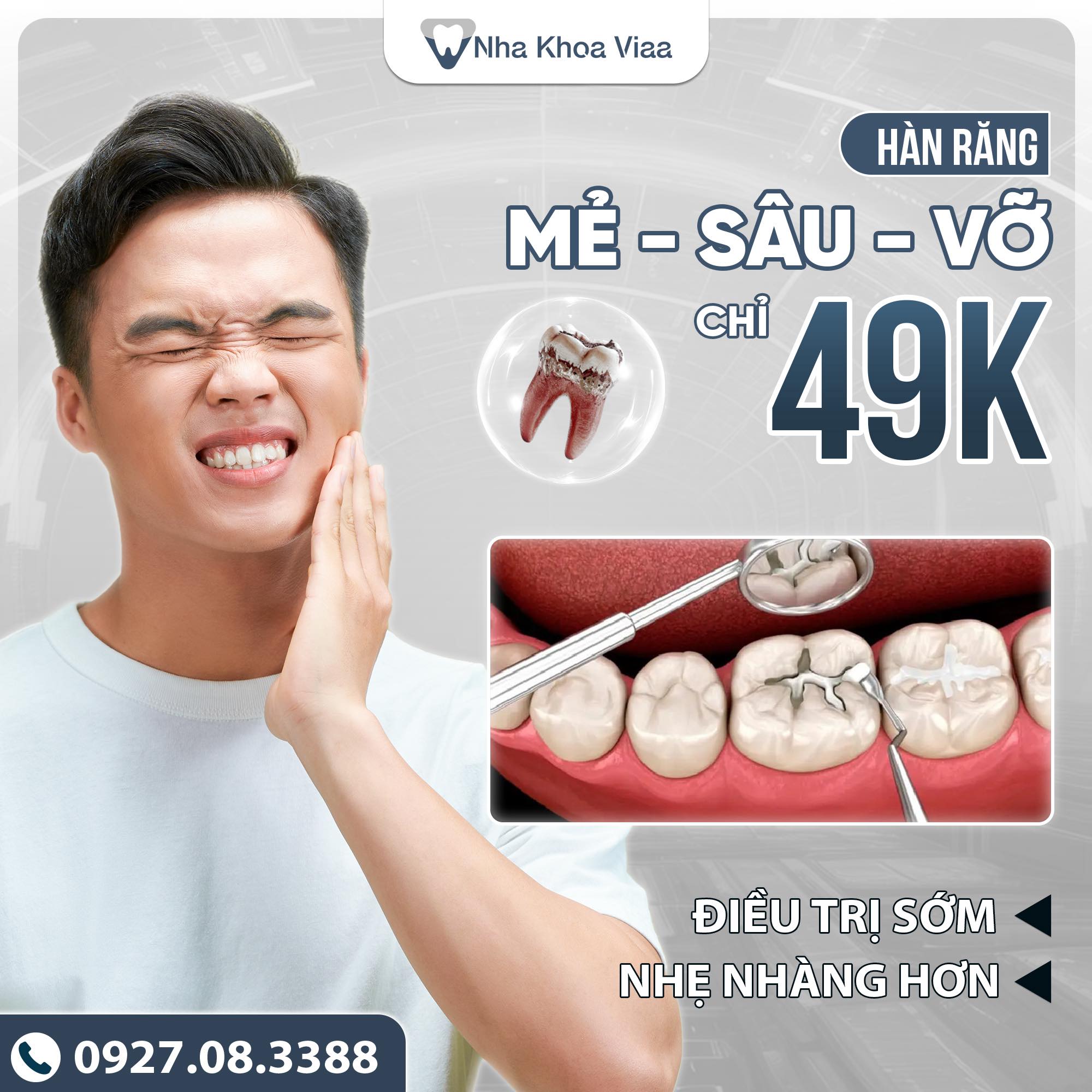 Viaa Dental Facebook ad: HÀN RĂNG ĐỒNG GIÁ 49k