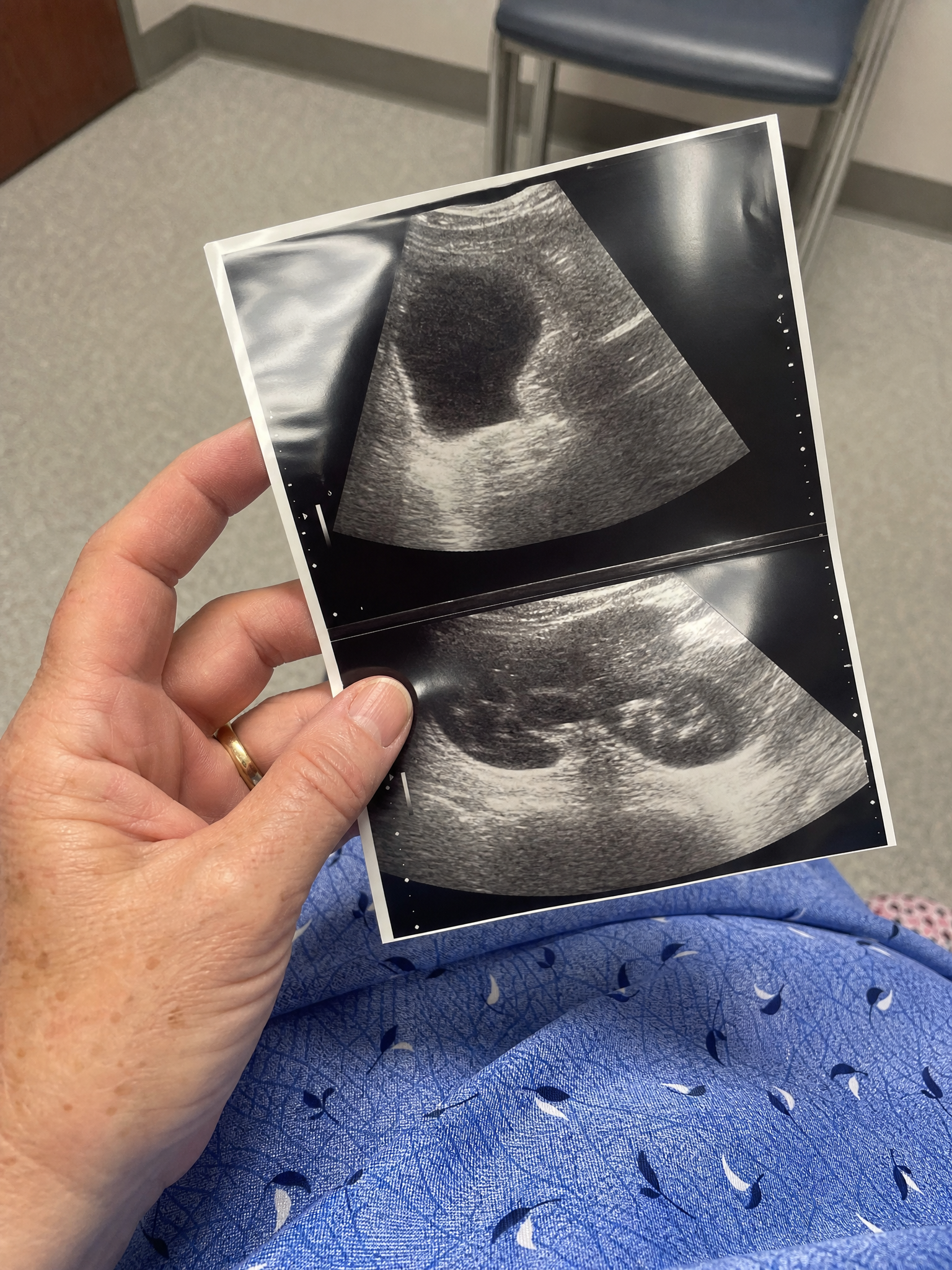 Women's Health Report Facebook ad: Por qué cada ronda de antibióticos hace que la siguiente…
