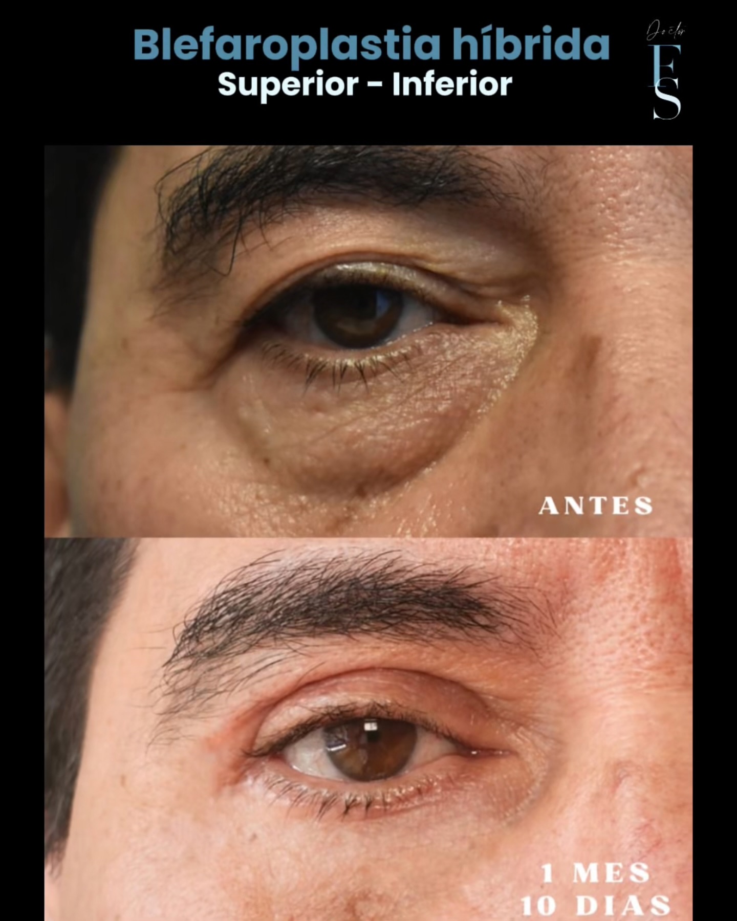 Dr. Felipe Suarez Facebook ad