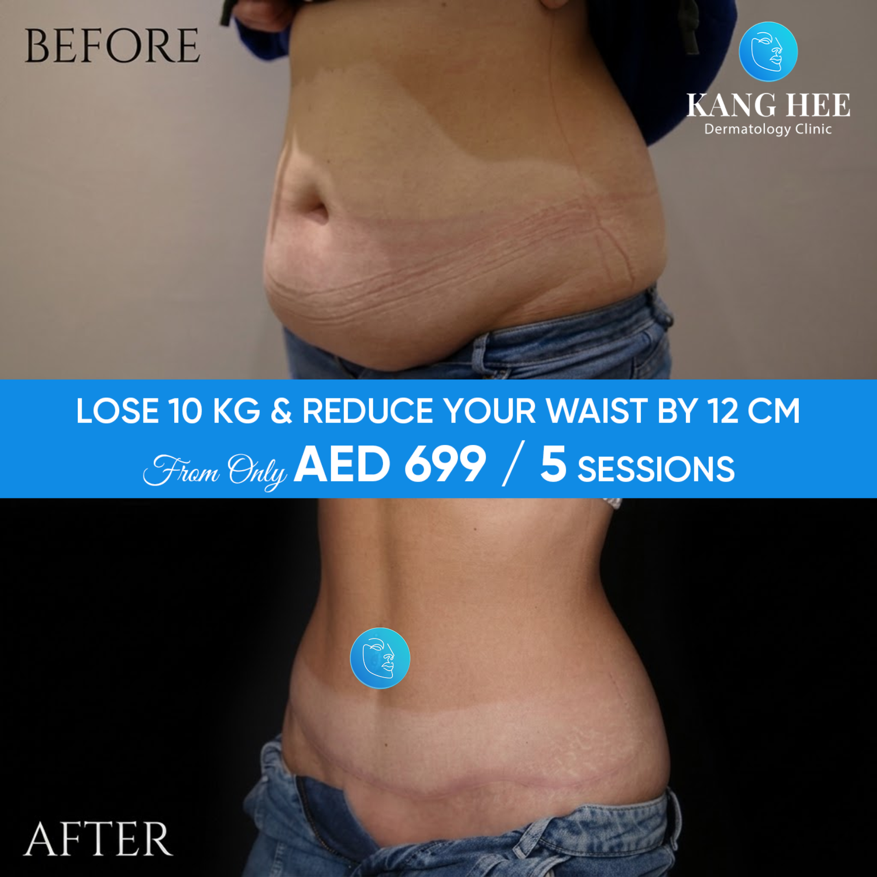 KangHee International Aesthetic Institute Facebook ad: LOSE 10KG JUST 1 FULL TREATMENT