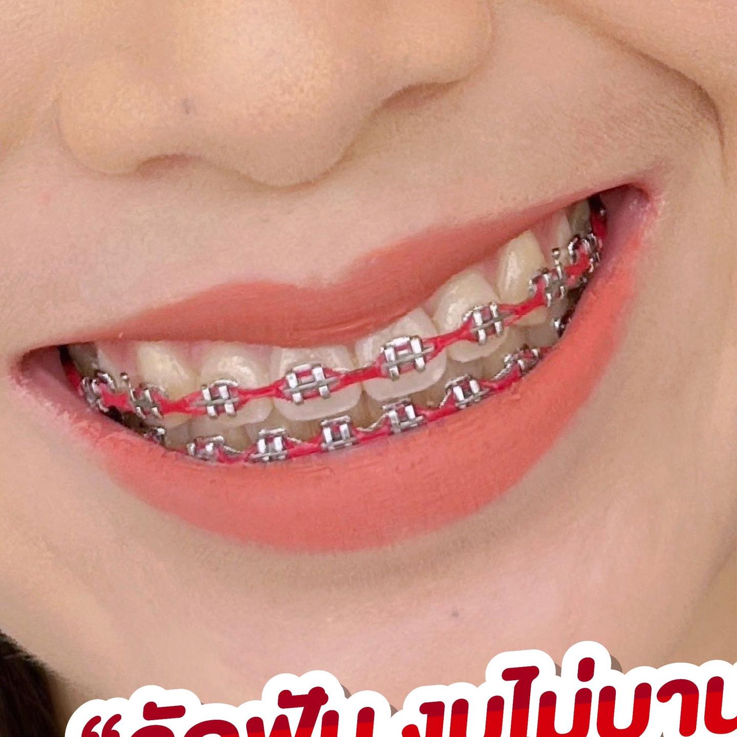Itooth dental clinic ทันตกรรม ครบวงจร Facebook ad