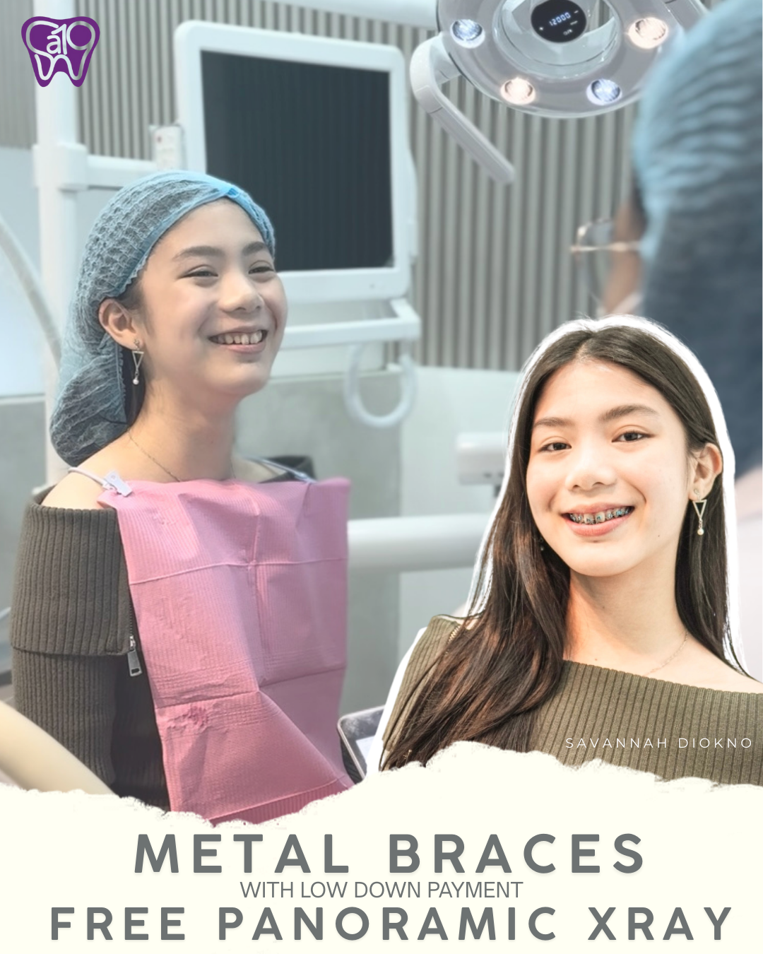 SA19 Le Tooth Dental Clinic - Makati Facebook ad