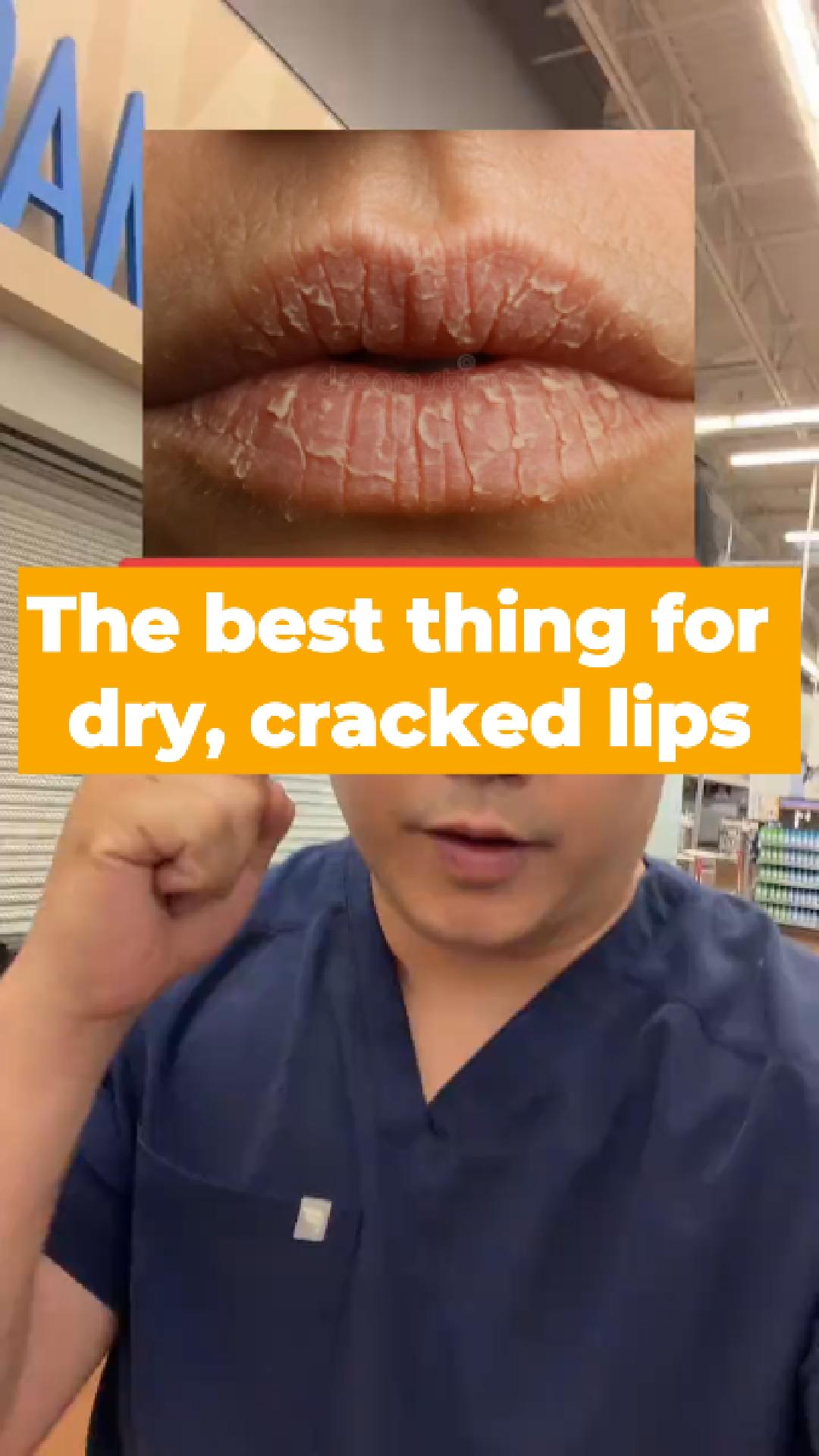Rphreviews Facebook ad: If you have cracked dry lips, this serum…