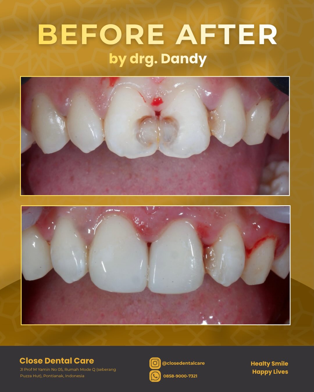 closedentalcare Facebook ad: Senyum yang lebih rapi, natural, dan bikin makin…