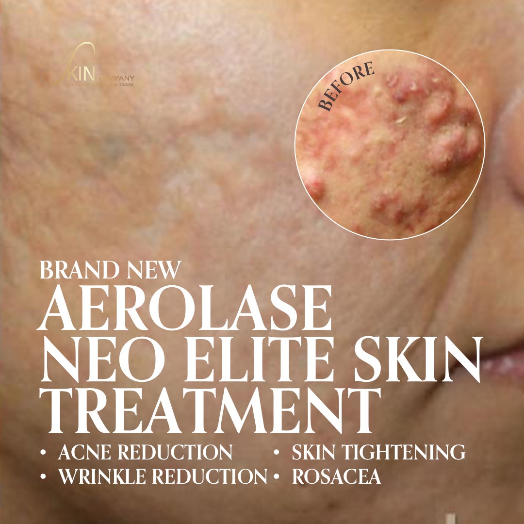 The Skin Company BA Facebook ad