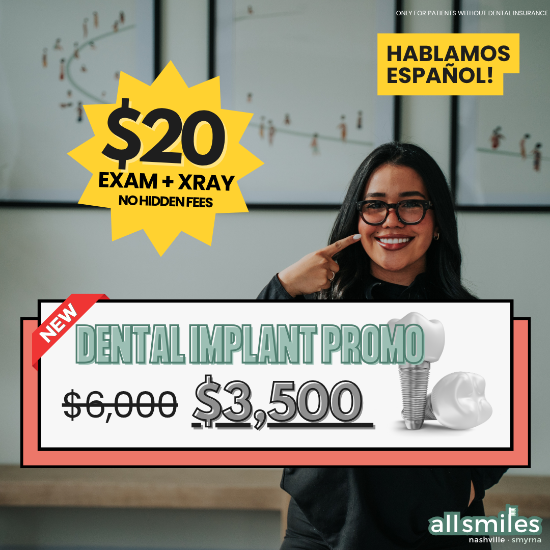 All Smiles Tennessee Facebook ad: Implants Program Nashville