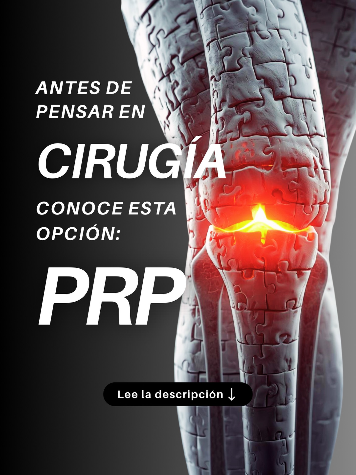 FisioSpa Facebook ad: Cada escalón duele y tu rodilla no pide…