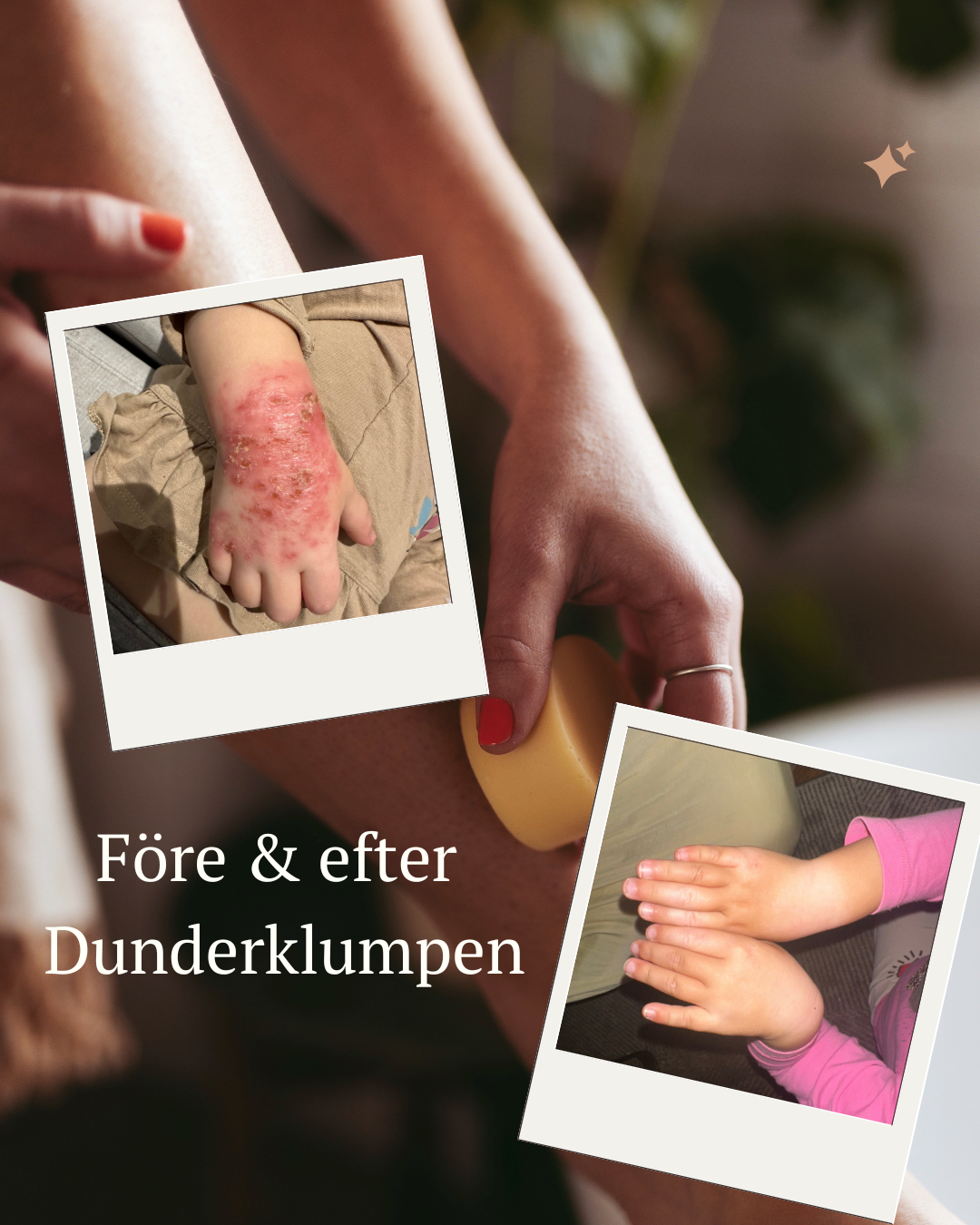 HUMLE från Kalvsved Facebook ad: Dunderklumpen, för den allra torraste huden