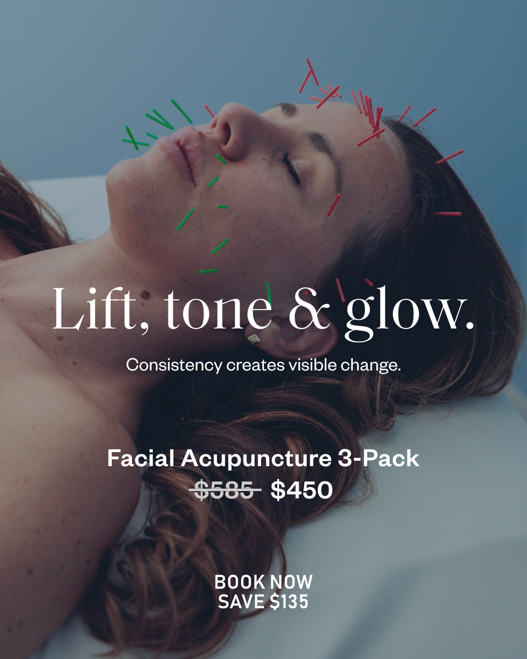 WTHN Acupuncture Facebook ad