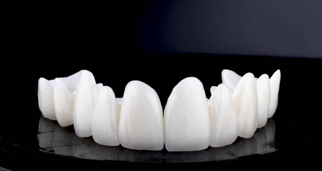 Dent Clinic Turkey Facebook ad: Full Set Smile Design