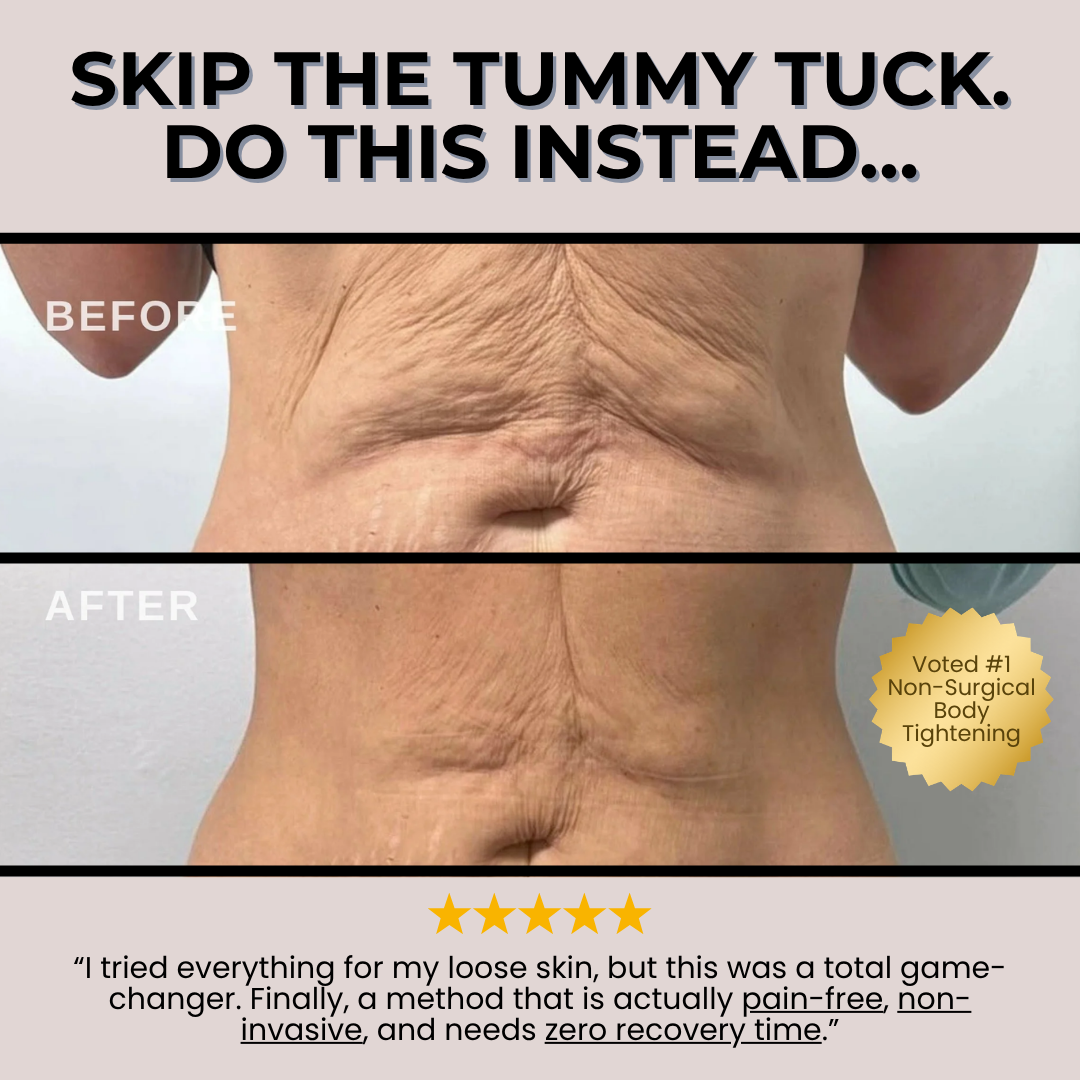 Giovanni Med Spa Facebook ad: Bye-Bye Cellulite Treatment NOW $179