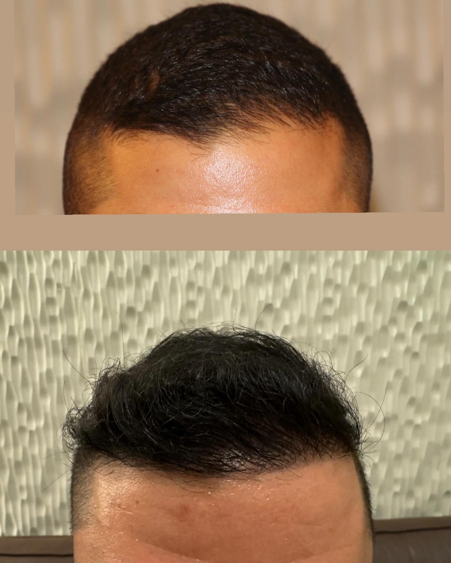 Modena Hair Institute Facebook ad