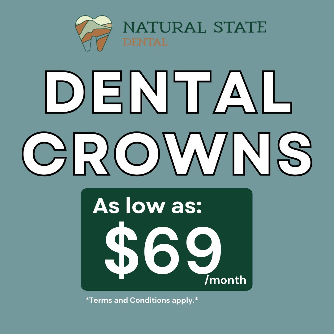 Natural State Dental Facebook ad: Dental Crowns As Low As $69/month