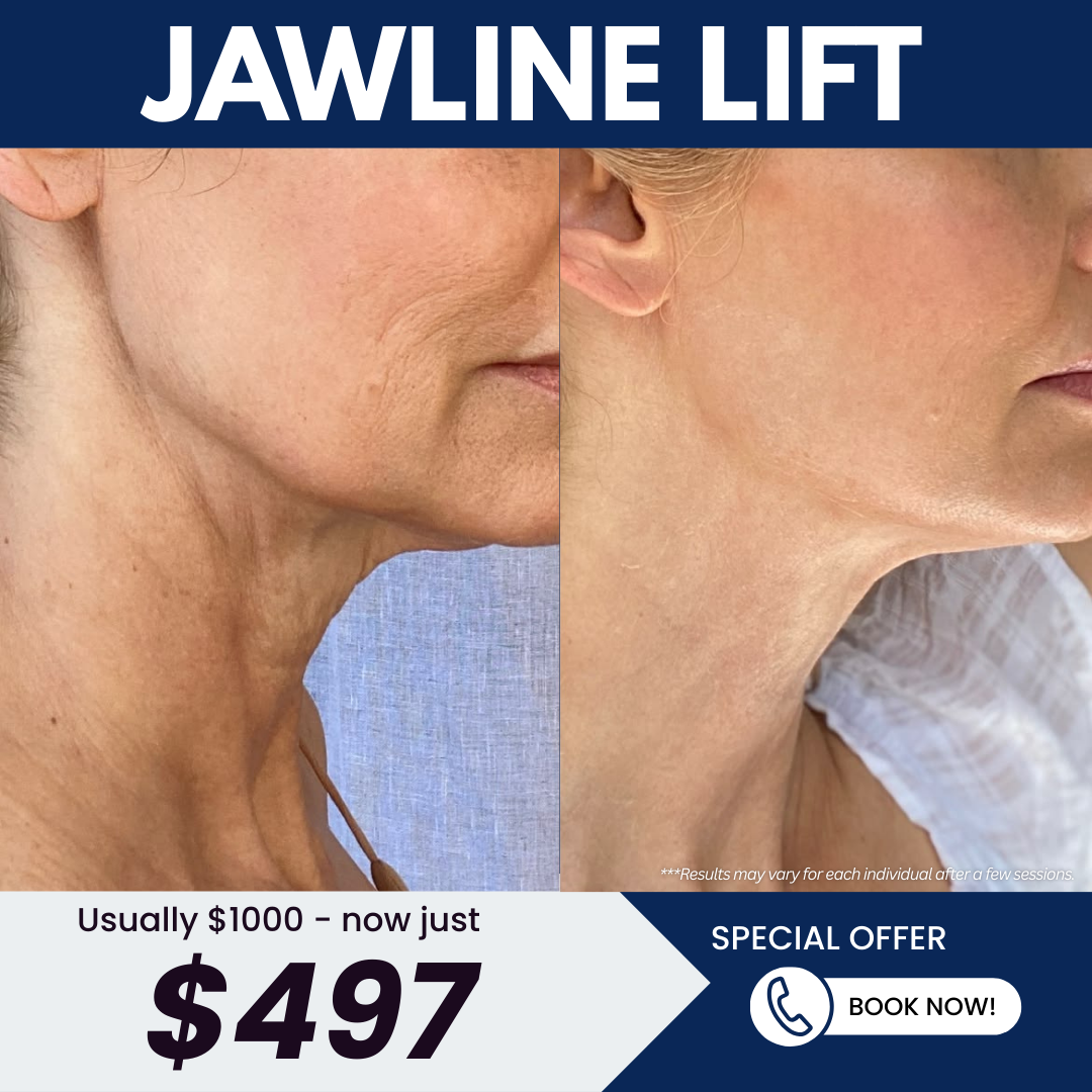 Aesthetics Health & Wellness Medspa Facebook ad: Jawline Lift for Only $497!