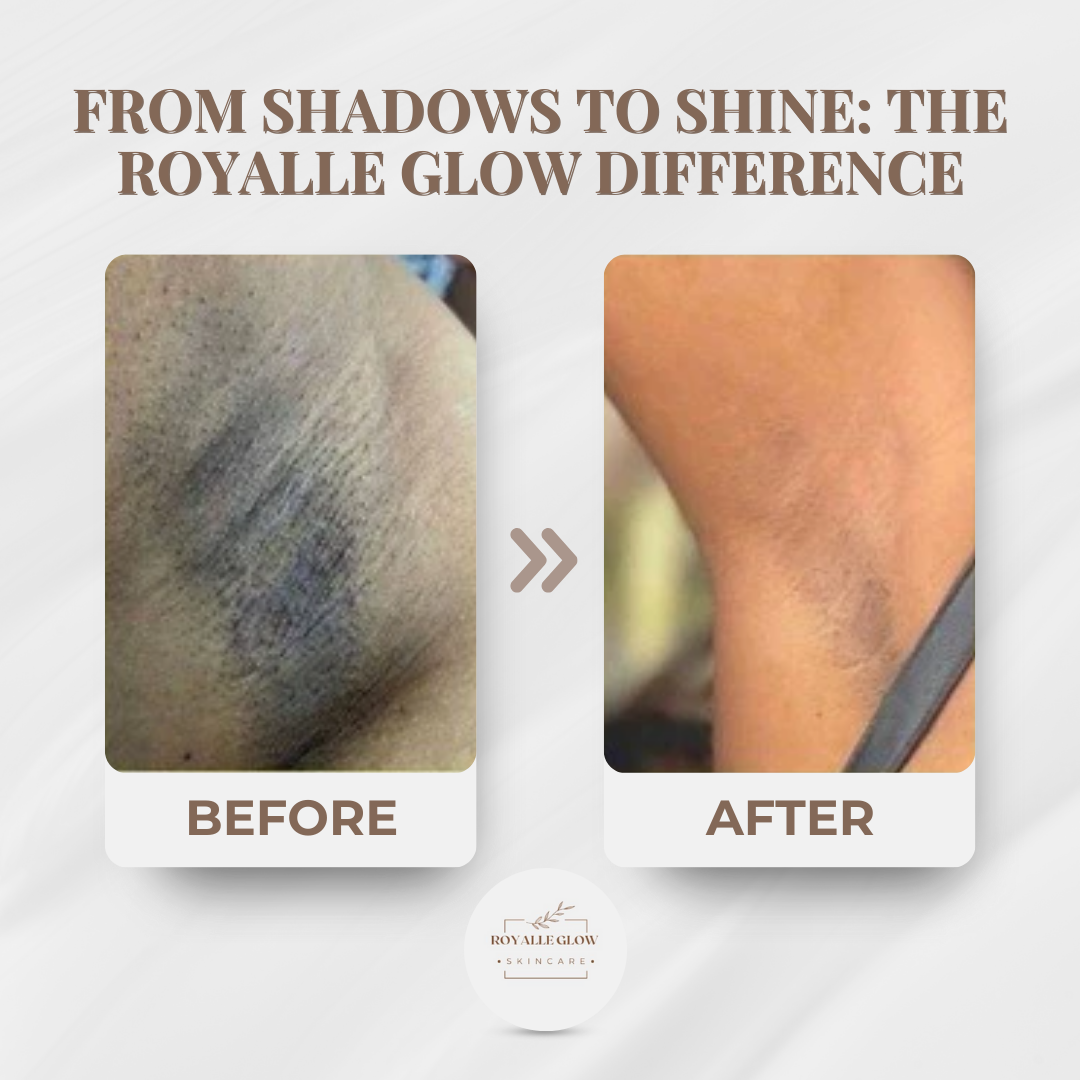 Royalle Glow Skincare Facebook ad: Dark Spots? Not On Our Watch-Glow Starts NOW!