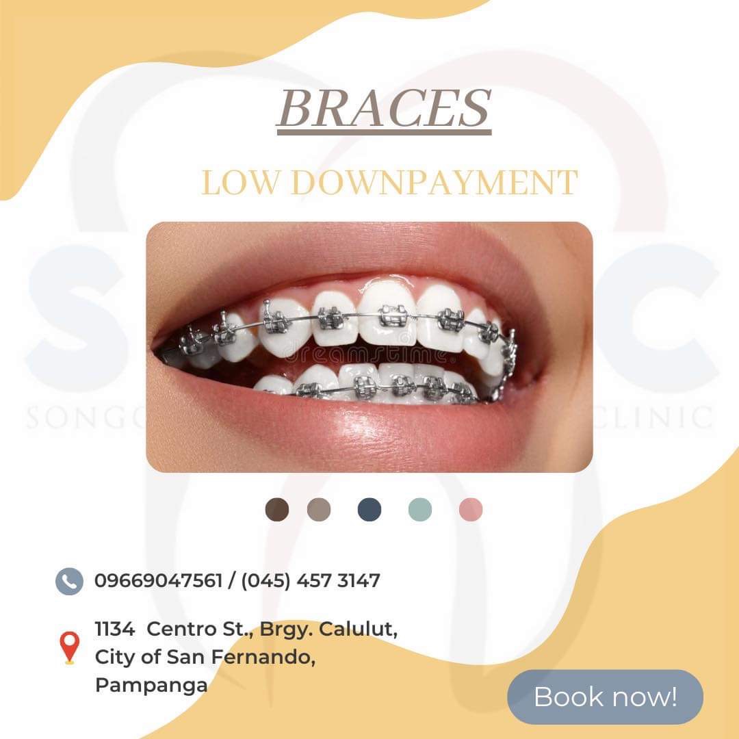 Songco Dental and Medical Clinic Facebook ad