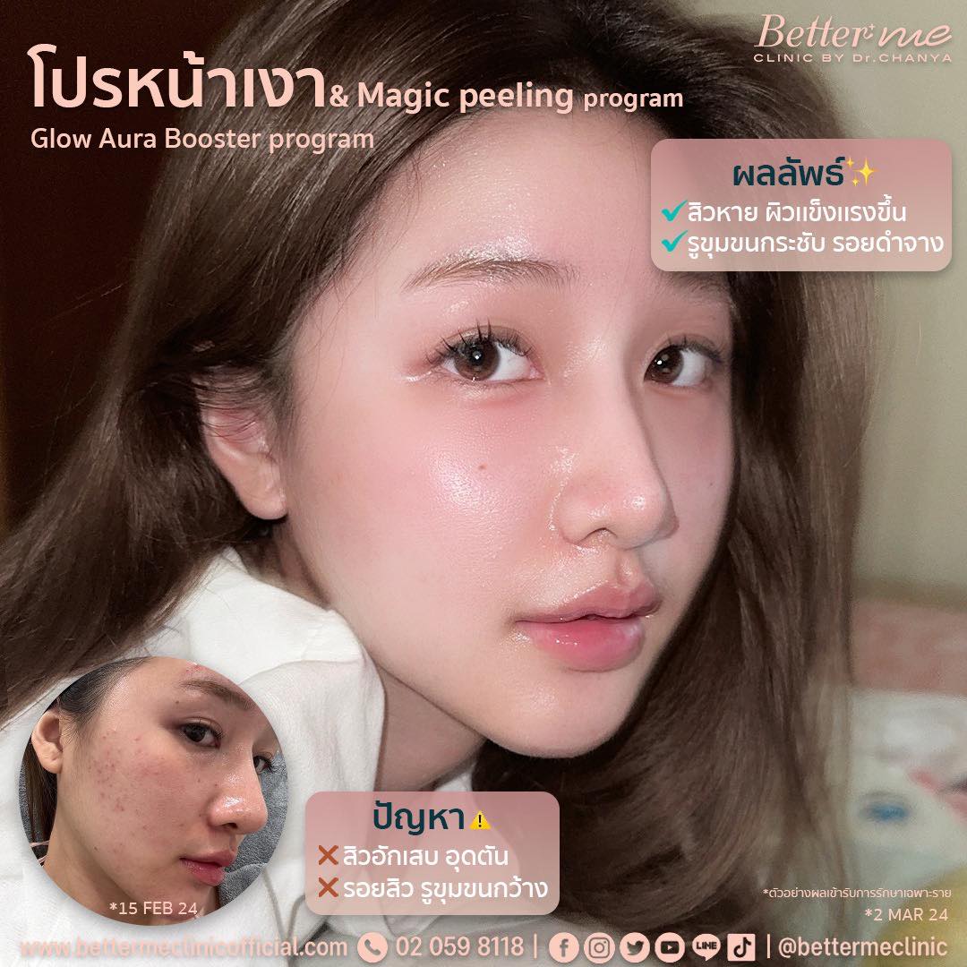 Better Me Clinic Facebook ad: ช่วยให้ผิวกระจ่างใส รูขุมขนกระชับ…