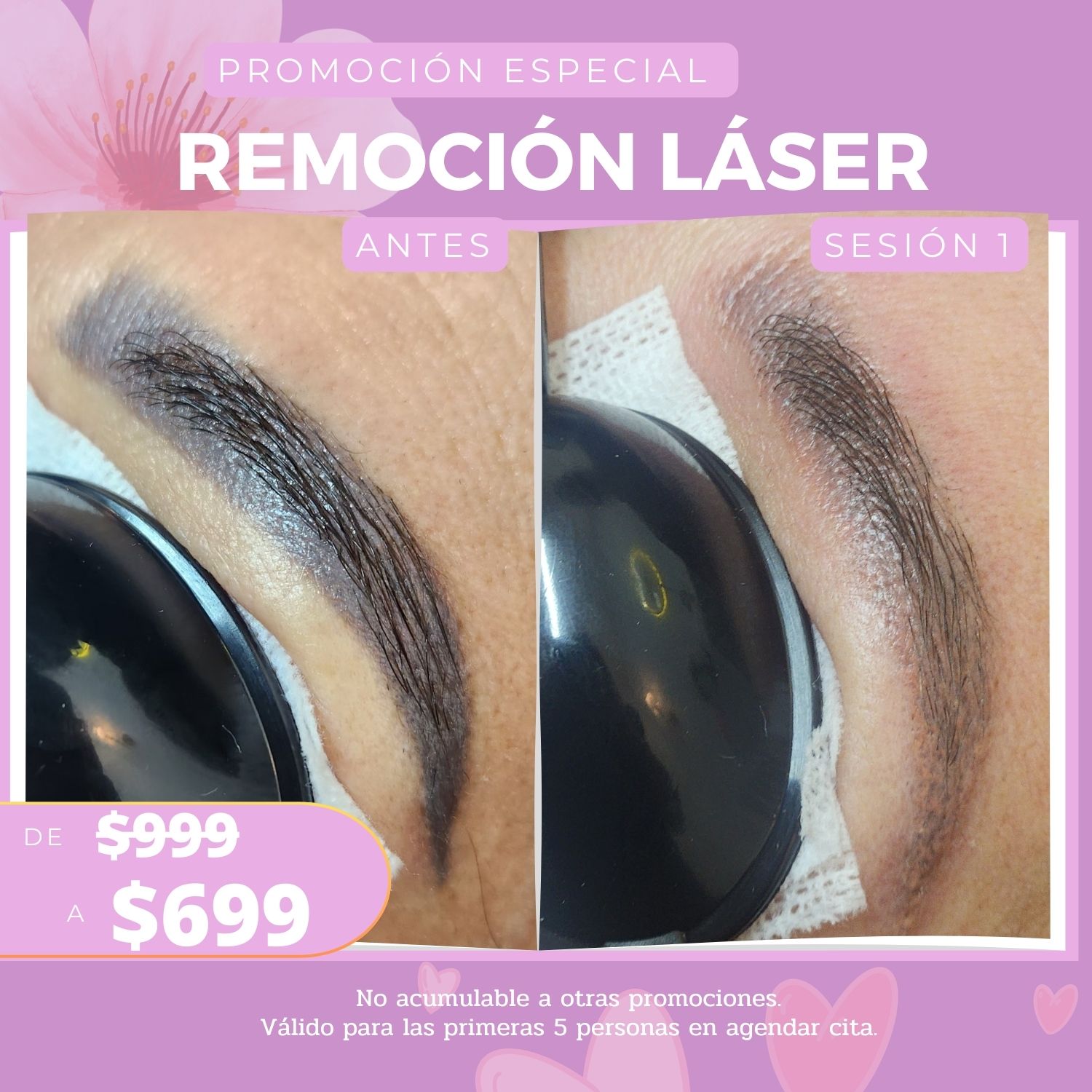 Micropigmentación y microblading by Paola Restrepo Facebook ad: ¿Te hicieron una micropigmentación que no te gustó?
