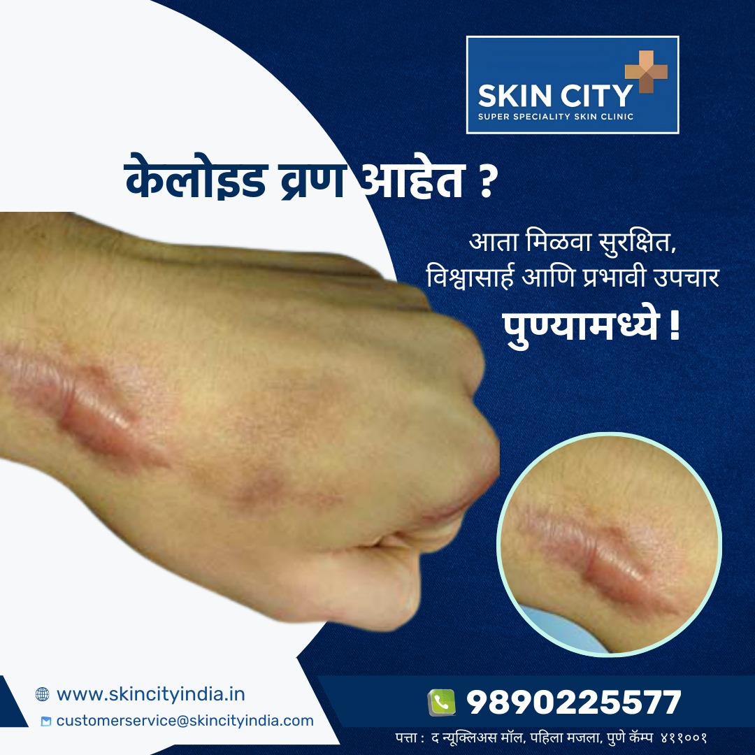 Dr. Dhepe's Skin City Facebook ad