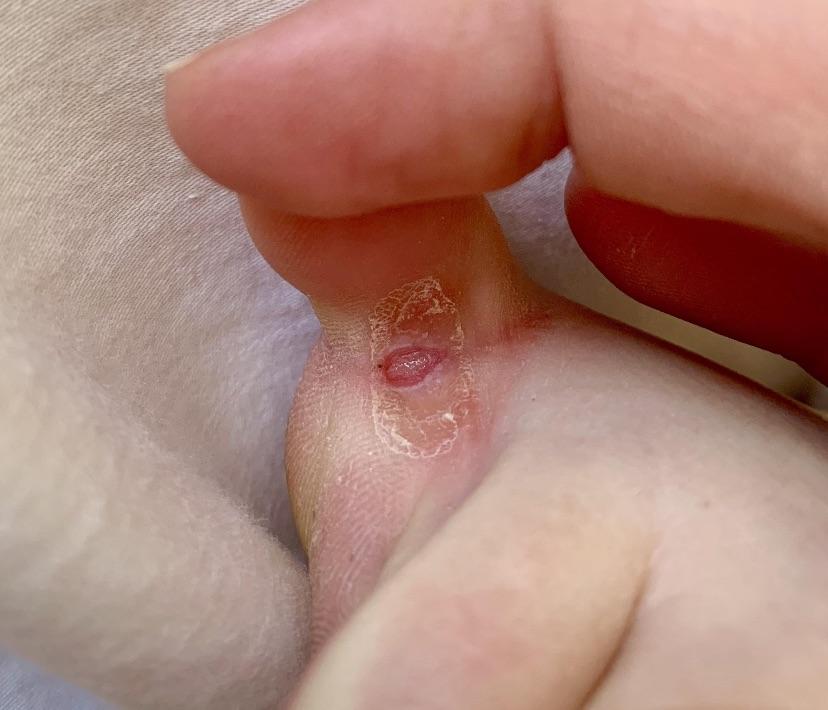 Nicole Parker Facebook ad: My doctor told me to wait until I finished breastfeeding…