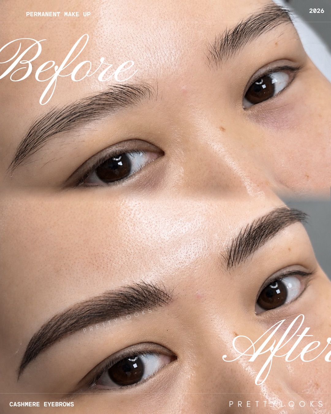 Prettylooks Facebook ad: Swipe for the transformations.