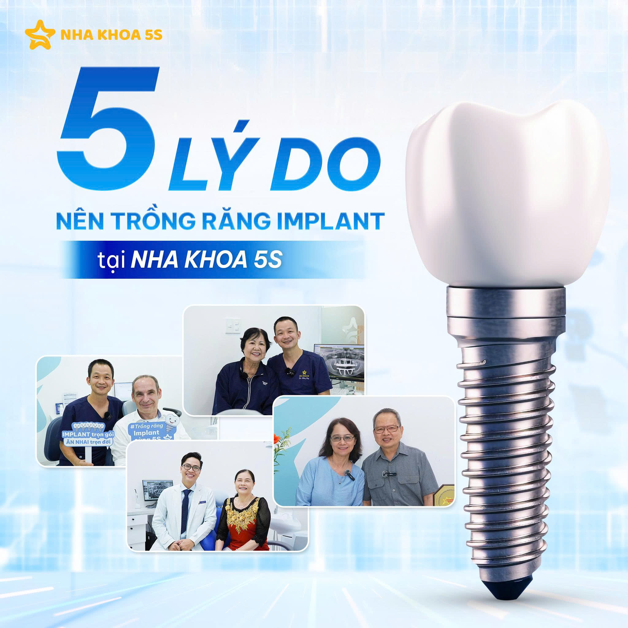 Nha Khoa 5S Facebook ad: 5 LÝ DO NÊN TRỒNG RĂNG IMPLANT TẠI…