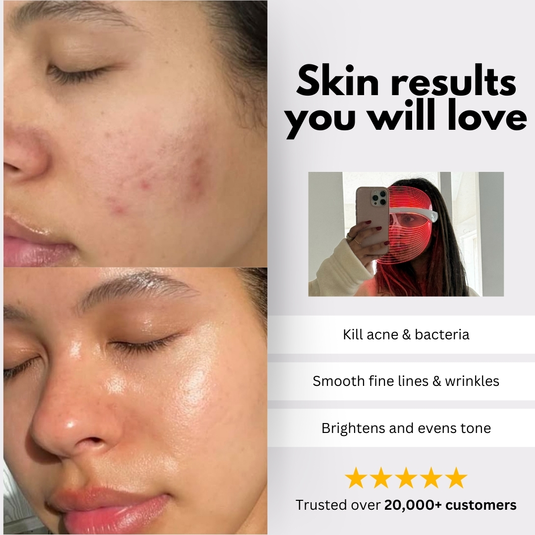 Selfcare Social Facebook ad