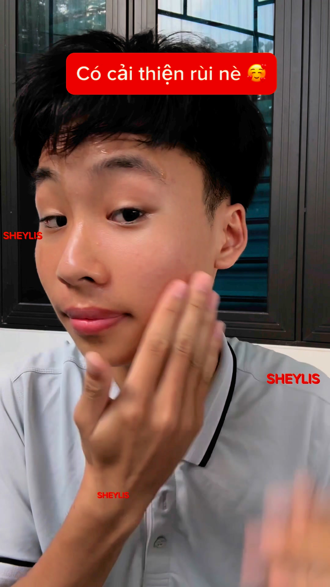 Sheylis - Chuyên Trị Mụn, Sáng Da, Mờ Thâm Sẹo Facebook ad: Nhận ưu đãi 1 tặng 1.
