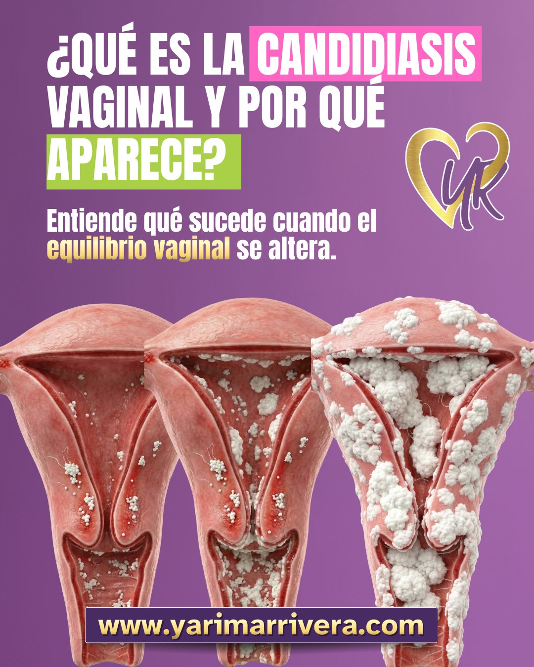 Bienestar Intimo YR Facebook ad: Si has tenido picazón, ardor o flujo espeso……