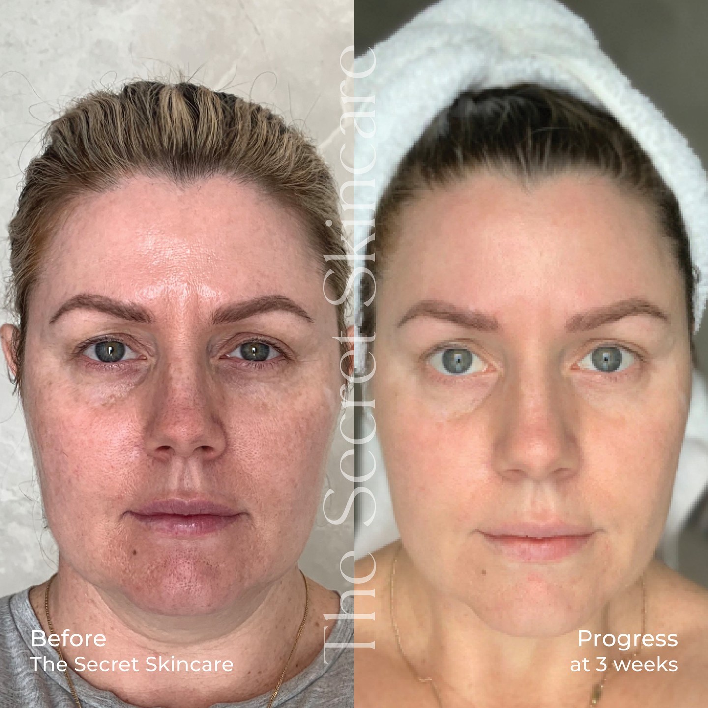 The Secret Skincare Facebook ad: I have tried every skin treatment and facial…