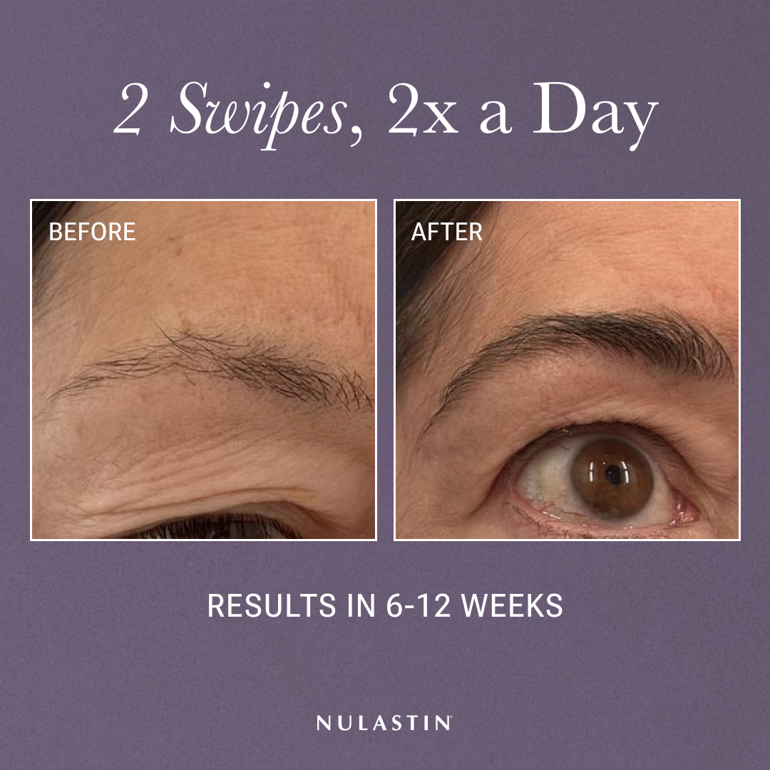 NULASTIN Facebook ad