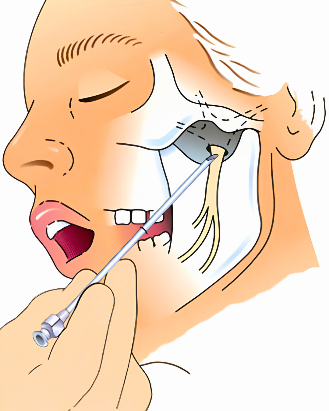 Allison Arnold - Migraine Coach Facebook ad