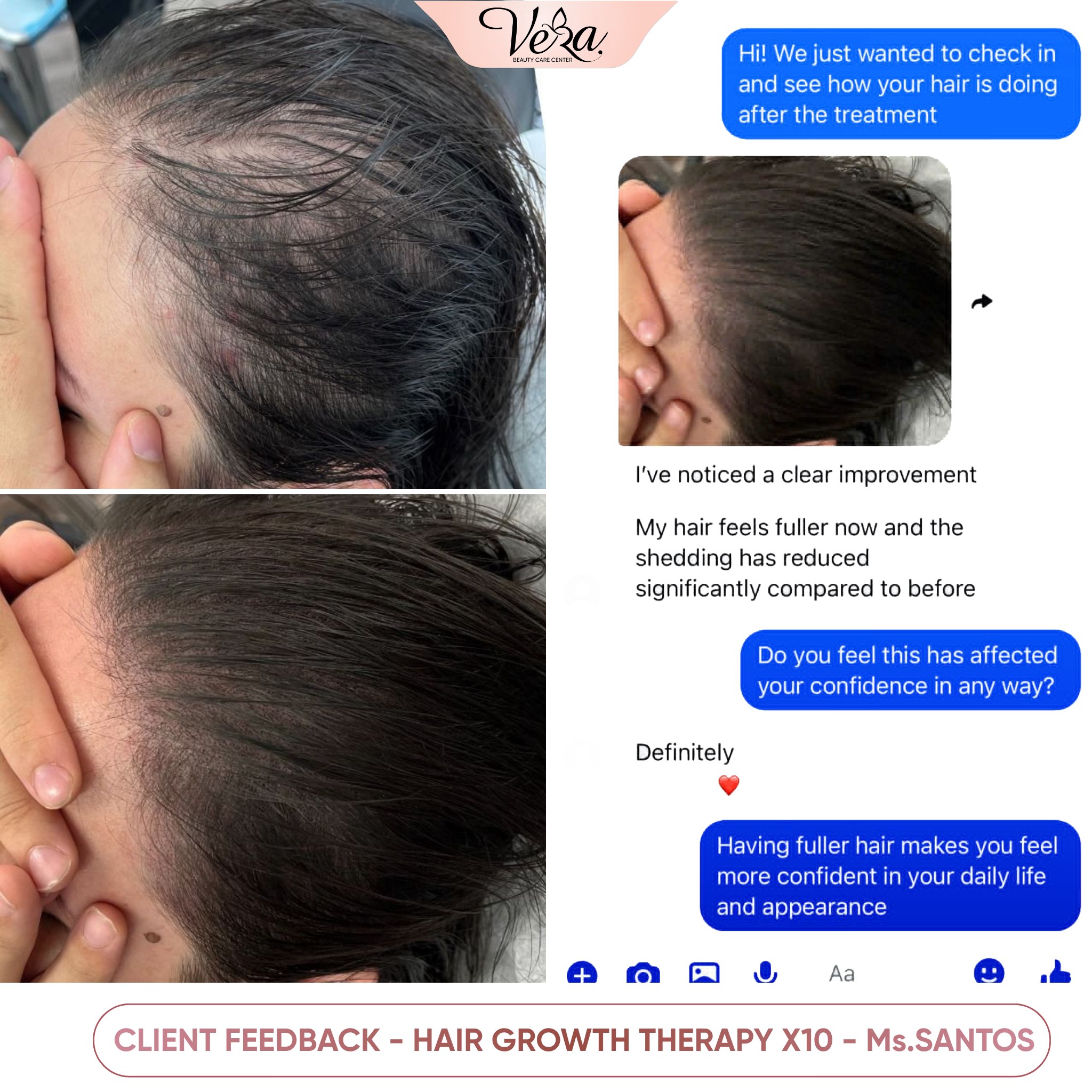 Vera Hair Facebook ad